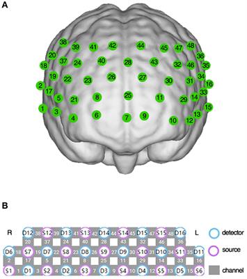 Atypical frontotemporal cortical activity in first-episode adolescent-onset schizophrenia during verbal fluency task: A functional near-infrared spectroscopy study